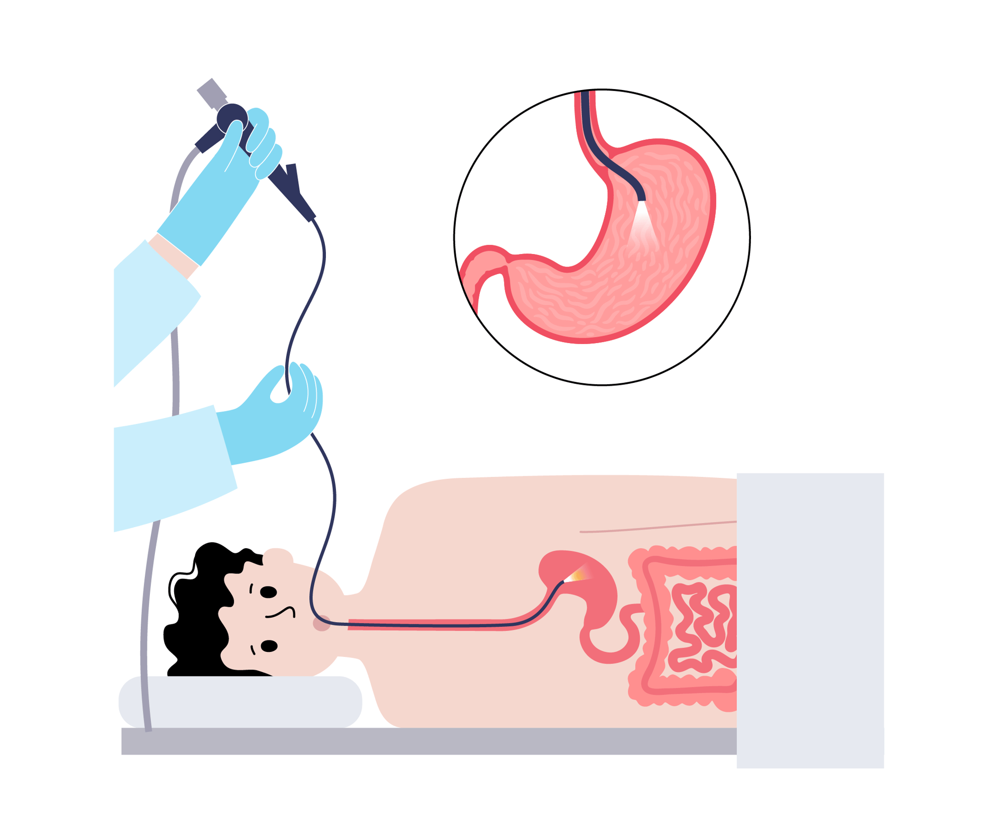Gastroscopy